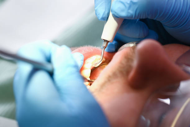 Best Emergency Tooth Extraction  in Maple Lake, MN